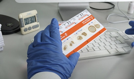 تصویر 1 از کیت آیمایش خون مخفی در مدفوع استریلیزه شده و با کیفیت